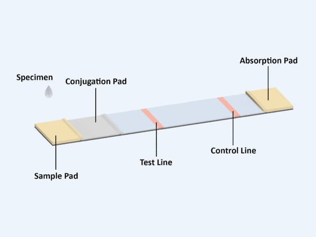 Treponema pallidum Point-of-Care Diagnostic Kit